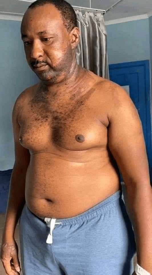 Jealous wife pours hot water on husband after buying new phone for his sidechick in Imo (PHOTOS)
