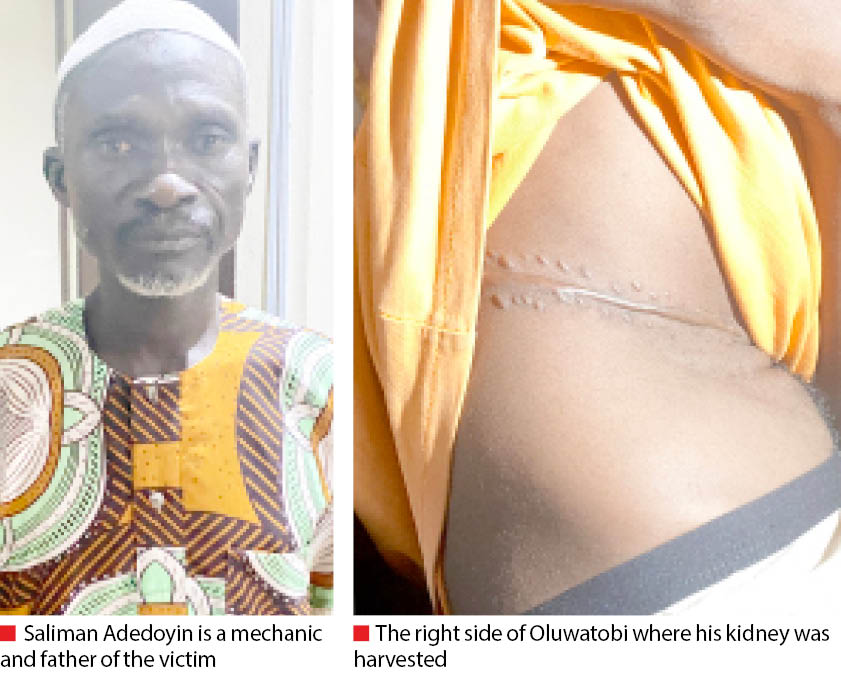 1692427279 44 Organ exploitation How Abuja syndicate lured minor for kidney harvest