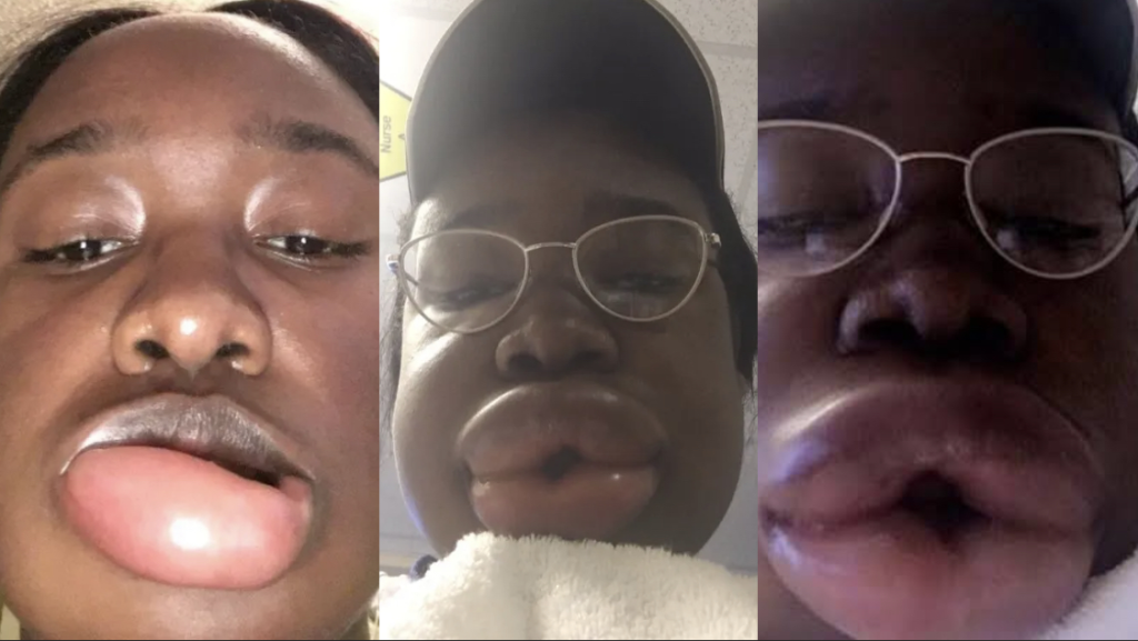 “Please help me, I’m Dieing ” – A Lady Advised after used This!...