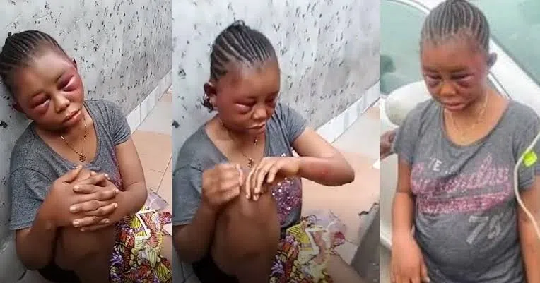 19-year-old girls Face Redesigned by her boyfriend for cheating (Video)
