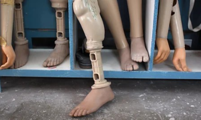 Foundation Distributes 300 Free Artificial Limbs To Amputees In Anambra State