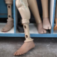 Foundation Distributes 300 Free Artificial Limbs To Amputees In Anambra State