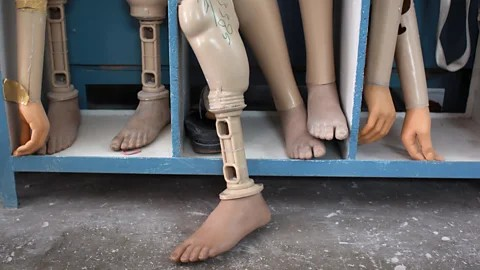 Foundation Distributes 300 Free Artificial Limbs To Amputees In Anambra State