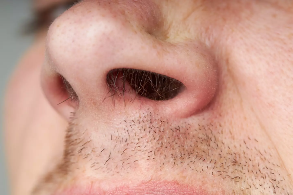 Doctor advises against plucking nose hair to avoid the 'triangle of death' risk