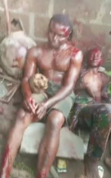 Cemetery Worker And Accomplices Arrested With Five Human Skulls