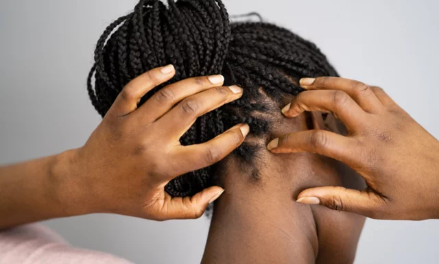 5 Natural Remedies To Soothe And Treat A Dry Scalp