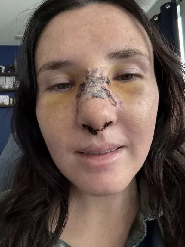 'Perfect' dog turned into 'aggressive' savage ripping mum's nose off – she has theory why