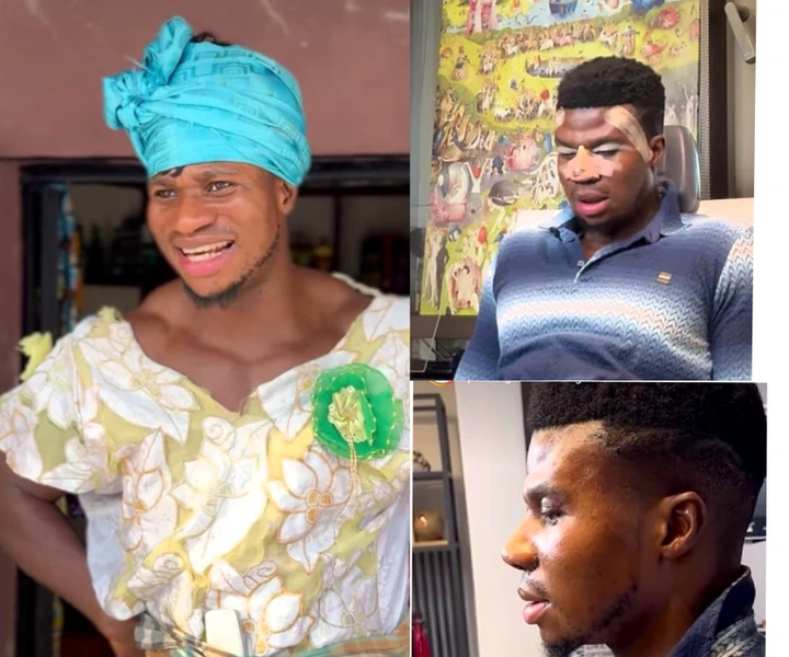 Nigerian Comedian Aloma Isaac Sparks Reactions with Nose Surgery Transformation Video