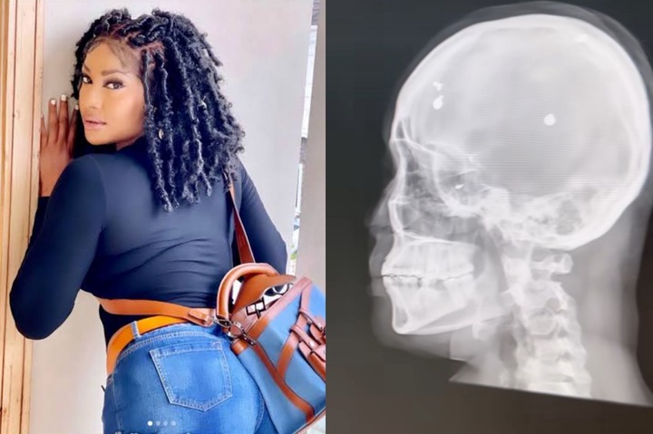 Angela Okorie Reveals Bullet Pellets Still in Her Head, Seeks Public Prayers