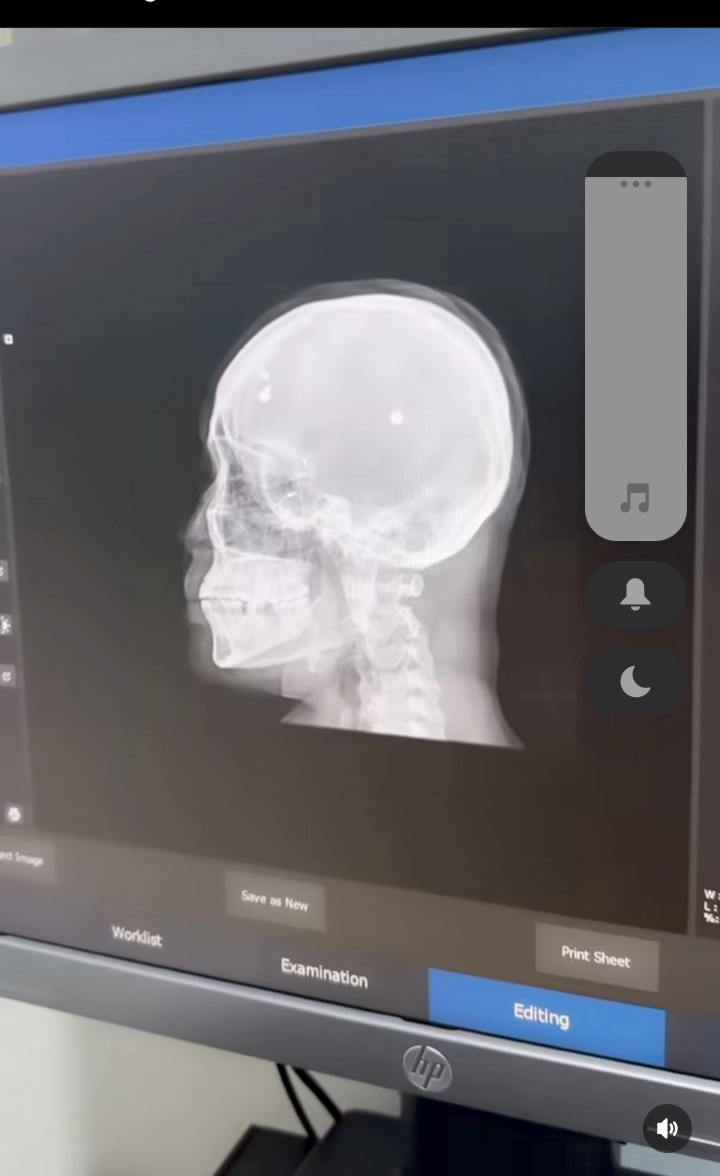 Angela Okorie Reveals Bullet Pellets Still in Her Head, Seeks Public Prayers